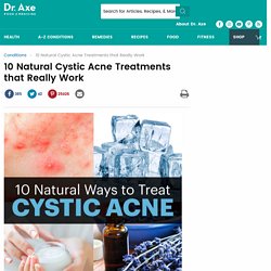 10 Natural Cystic Acne Treatments that Really Work