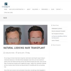 Natural Looking Hair Transplant - Cooley Hair Center