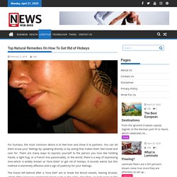 Top Natural Remedies On How To Get Rid of Hickeys By News Web Zone