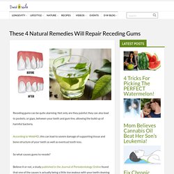 These 4 Natural Remedies Will Repair Receding Gums
