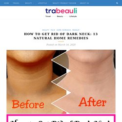 How to Get Rid of Dark Neck: 13 Natural Home Remedies - Trabeauli
