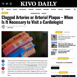 Clogged Arteries or Arterial Plaque – When Is It Necessary to Visit a Cardiologist