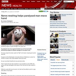 Nerve rewiring helps paralysed man move hand - Pentadactyl