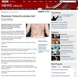 Psoriasis 'linked to stroke risk'