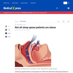 Not all sleep apnea patients are obese