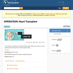 OPERATION: Heart Transplant