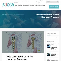 Post-Operative Care for Humerus Fracture