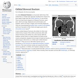 Orbital blowout fracture - Wikipedia