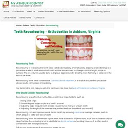 Teeth Recontouring - VA Orthodontics