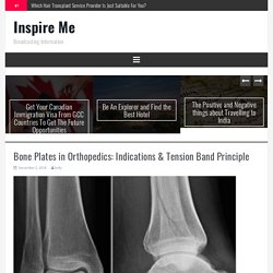 Bone Plates in Orthopedics: Indications & Tension Band Principle