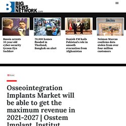 Osseointegration Implants Market will be able to get the maximum revenue in 2021-2027