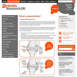 What is osteoarthritis?