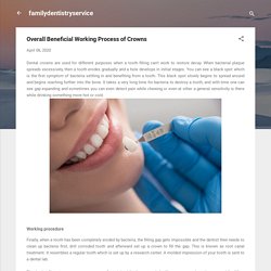 Overall Beneficial Working Process of Crowns