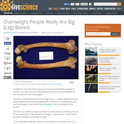 Overweight People Have Thicker Thigh Bones