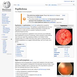 Papilledema