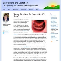 Tongue Tie - What Do Parents Need To Know?