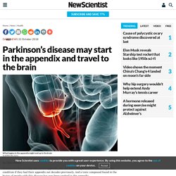 Parkinson’s disease may start in the appendix and travel to the brain