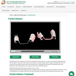 Partial Denture Treatment VA