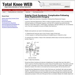 Patellar Clunk Syndrome: Complication Following Knee Replacement Surgery : TotalKneeWeb.com – Simple, Concise Information on Total Knee Replacement & Related Topics