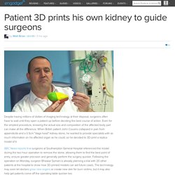 Patient 3D prints his own kidney to guide surgeons