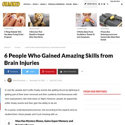 6 People Who Gained Amazing Skills from Brain Injuries