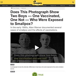 Does This Photograph Show Two Boys — One Vaccinated, One Not — Who Were Exposed to Smallpox?