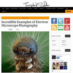 Incredible Examples of Electron Microscope Photography