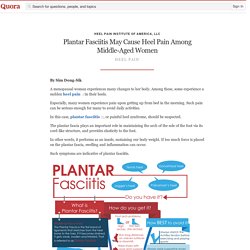 Plantar Fasciitis May Cause Heel Pain Among Middle-Aged Women