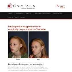 Facial plastic surgeon in Charlotte needed for an otoplasty