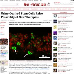 Urine-Derived Stem Cells Raise Possibility of New Therapies