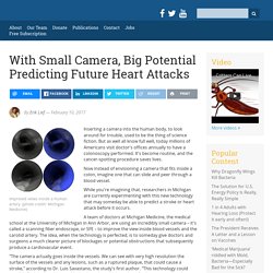 With Small Camera, Big Potential Predicting Future Heart Attacks