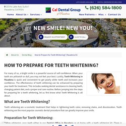 How to Prepare for Teeth Whitening?