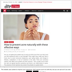How to prevent acne naturally with these effective ways