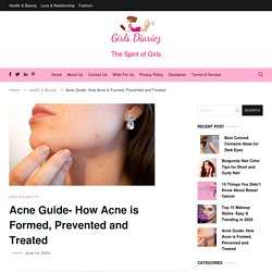 Acne Guide- How Acne is Formed, Prevented and Treated – Girls Diariez