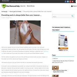 Preventing warts is always better than cure, however… – Wart Removal Help