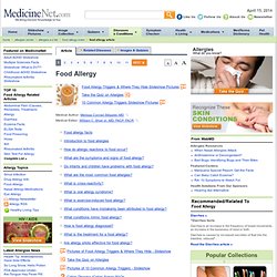 Food Allergy Test, Symptoms, Diagnosis, Treatment, Prevention, Signs and Causes of Allergies by MedicineNet