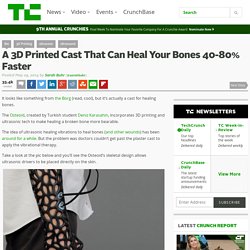 A 3D Printed Cast That Can Heal Your Bones 40-80% Faster