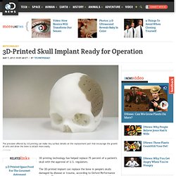 3D-Printed Skull Implant Ready for Operation
