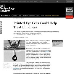 Eye Cells Made with Ink-Jet Printer