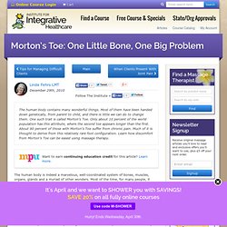 Morton's Toe: One Little Bone, One Big Problem