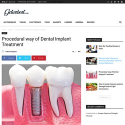 Procedural way of Dental Implant Treatment