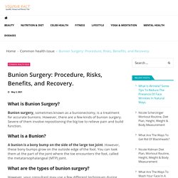 Bunion Surgery: Procedure, Risks, Benefits, and Recovery. - Vigourfact