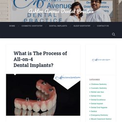 What is The Process of All-on-4 Dental Implants? – Ashton Avenue Dental Practice