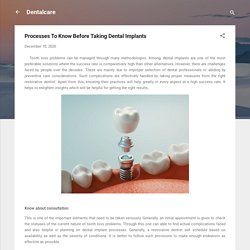 Processes To Know Before Taking Dental Implants