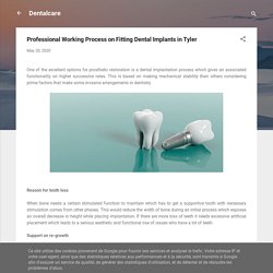 Professional Working Process on Fitting Dental Implants in Tyler