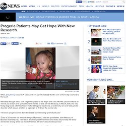 Progeria Patients May Find Hope in New Drug