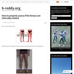 How to properly assess if the femurs are internally rotated