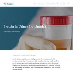 Protein in Urine (Proteinuria)