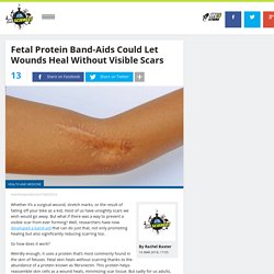 Fetal Protein Band-Aids Could Let Wounds Heal Without Visible Scars