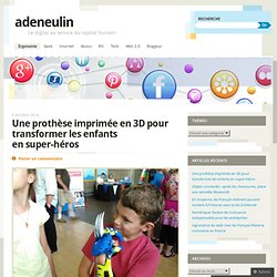 Une prothèse imprimée en 3D pour transformer les enfants en super-héros